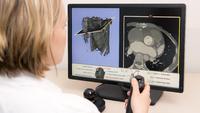 Ein Gamecontroller revolutioniert die Welt der Medizin
