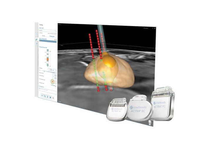 Medtronic SureTune[TM]3 Software erhält CE-Kennzeichnung für die Tiefe Hirnstimulation / Präsentation der Daten beim 17. Meeting der World Society for Stereotactic and Functional Neurosurgery (WSSFN) (FOTO)