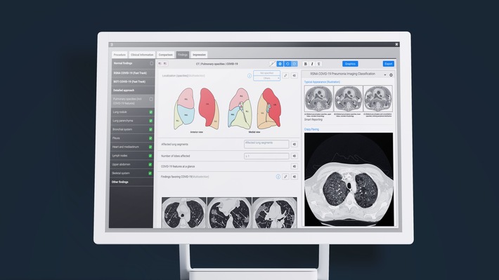 15 Millionen für Smart Reporting: yabeo ist Lead-Investor der Series B des Digital Health-Start-ups (FOTO)