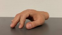 Forum Medizin zur Rapid.Tech 3D zeigt: Immer mehr additiv hergestellte Produkte erfüllen die hohen medizinischen Standards
