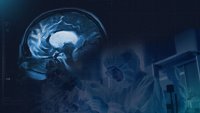 GEN und Sulfateq BV geben positive Ergebnisse aus ihrer Phase-1-Studie zum Prüfpräparat SUL-238 für die Behandlung der Alzheimer-Krankheit und anderer neurodegenerativer Erkrankungen bekannt