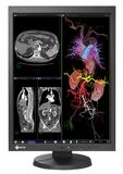 EIZO RadiForce MX215